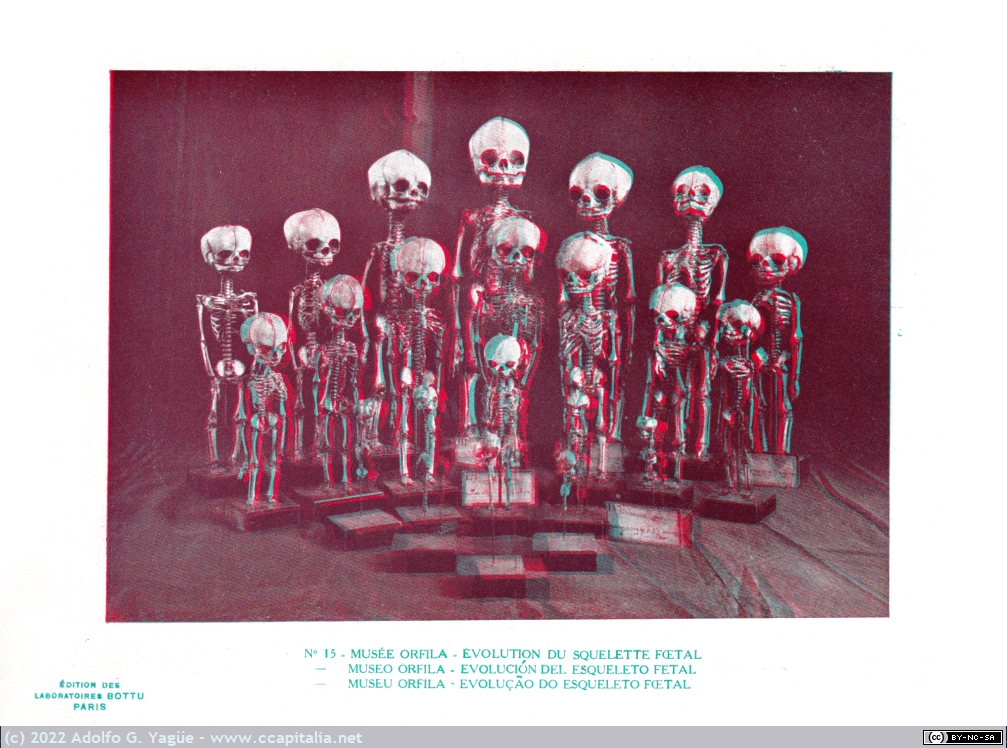 1570 - Imágenes anaglíficas promocionales de Laboratorios Farmaceuticos Bottu, París (5), Años 20