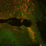 Mo12 hipo lesion 16x acris y GFAP