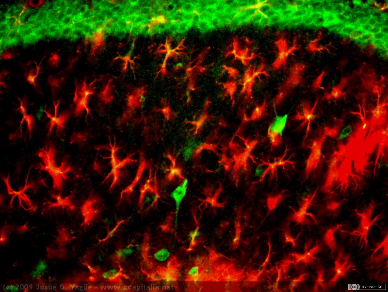 Mo12 hipo lesion CA1 arriba y radiatum de CA1 abajo acris y GFAP 20x otra