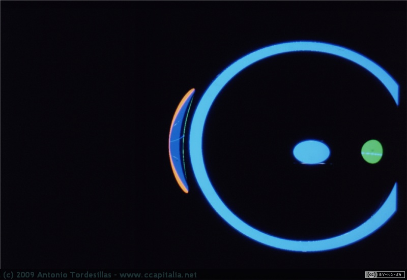 34 - Globo ocular
