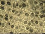 Células vegetales de una cebolla. Detalle de mitosis celular